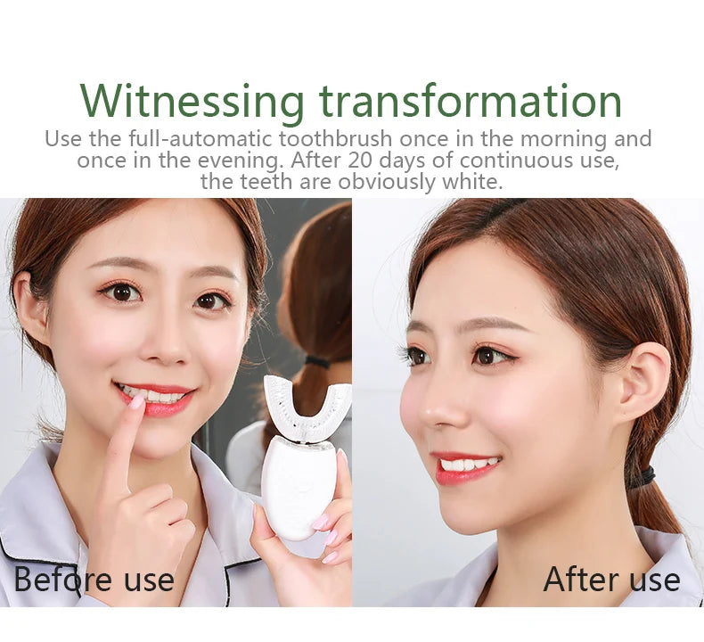 YasGlow™ Sonic 360 U-Shaped Toothbrush