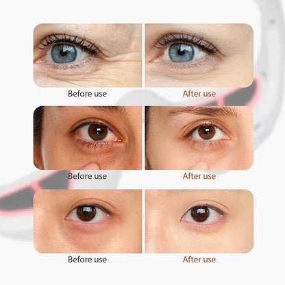 YasGlow™ EyeRelax Massager